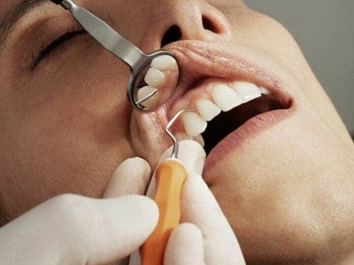 Parts of Teeth