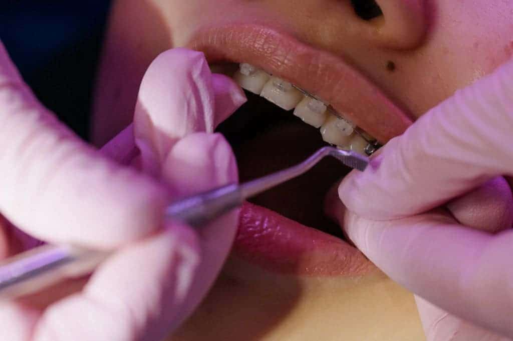 tooth extraction healing stages