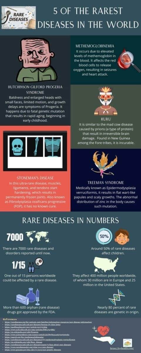 5 of The Rarest Diseases In The World