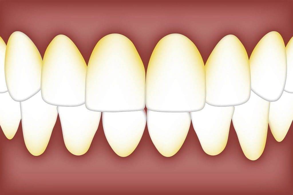 dental 3584756 1280
