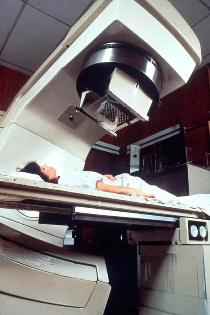 Radiation therapy Hodgkin's lymphoma