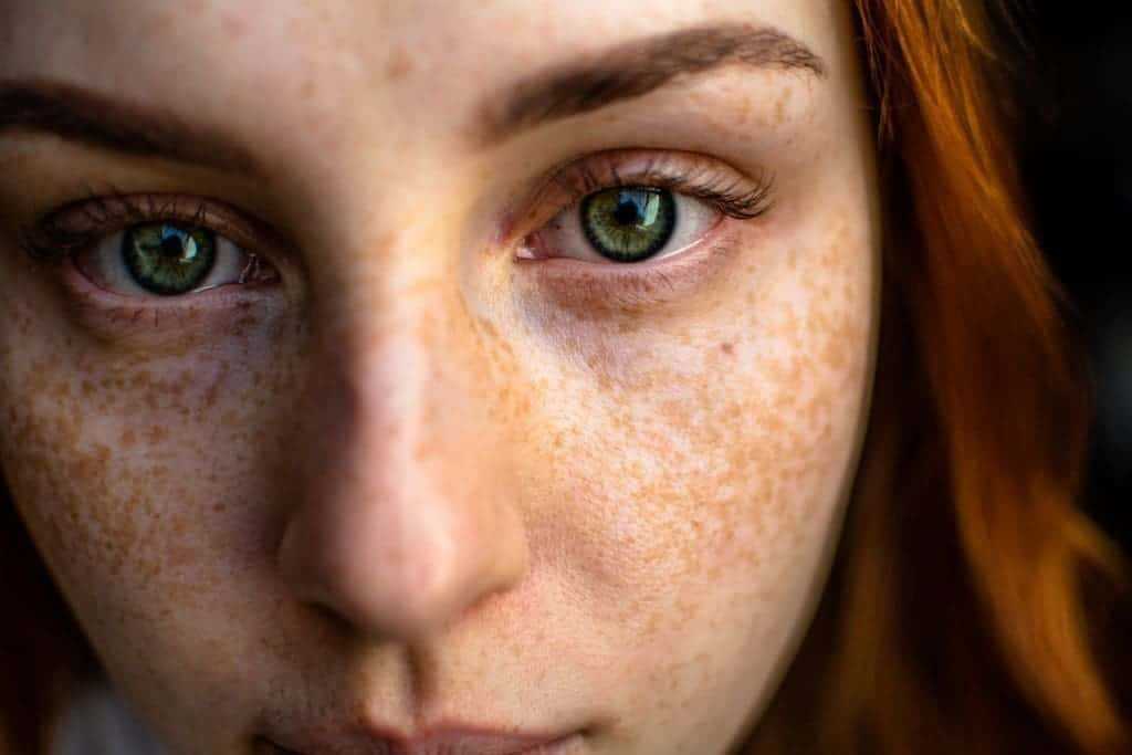 Tea Tree Oil for Acne: 3 Tips No One Told You About 2 Tea tree oil for acne