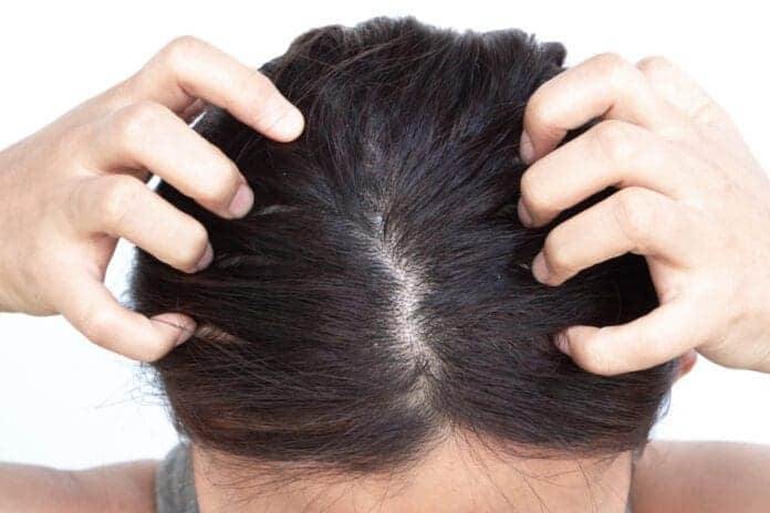 what causes dry scalp