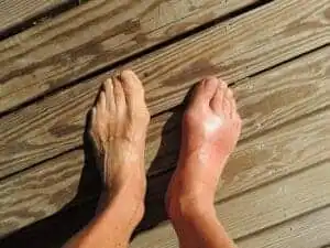 A Solution To Sore Ankles After Running 2 symptoms of sore ankles after running