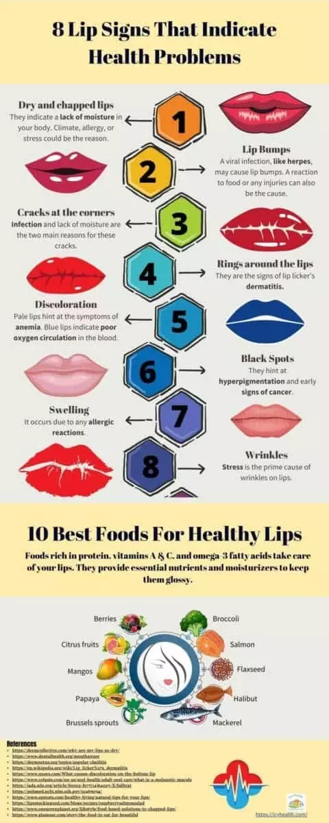 8 Lip Signs That Indicate Health Problems