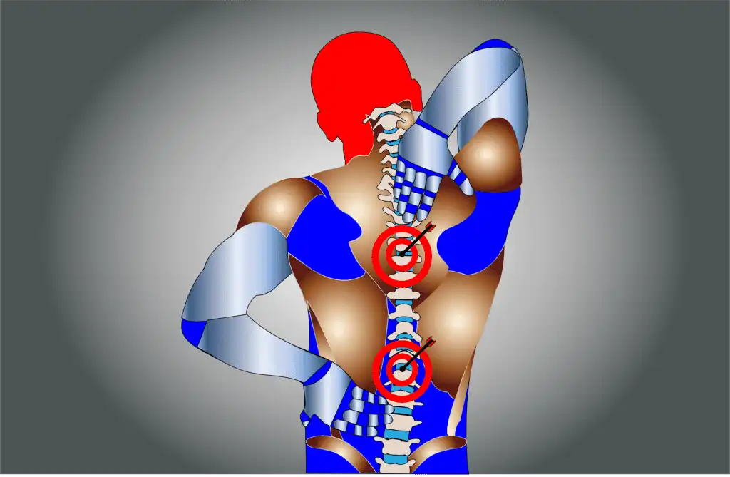 What is Lumbago: Symptoms, Causes and Cure 1 what is Lumbago