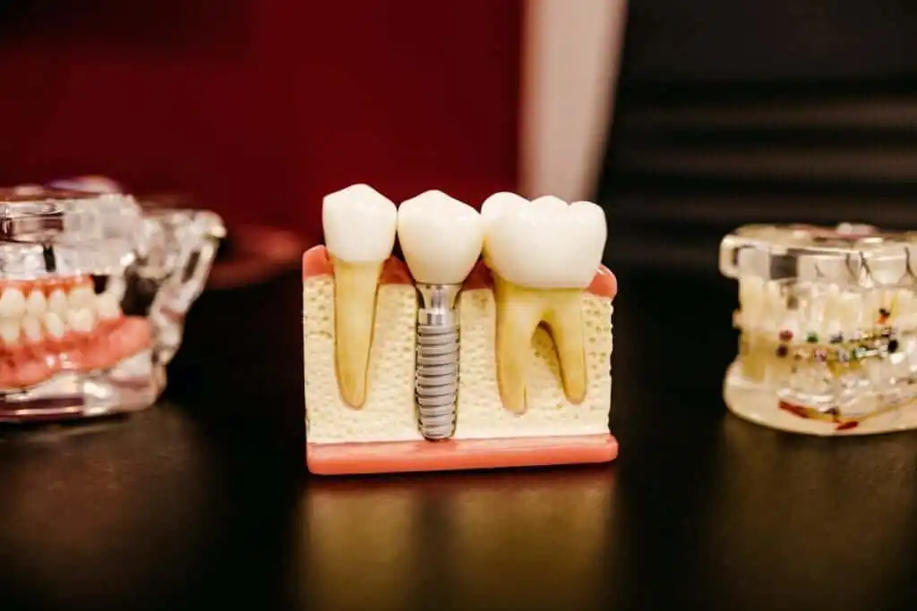 5 Unknown Cavity Stages Explained 2 jonathan-borba-W9YEY6G8LVM-unsplash.jpg