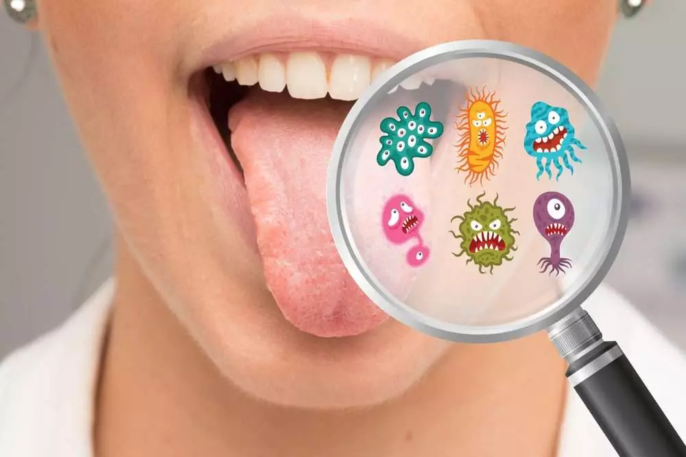 tongue bacteria