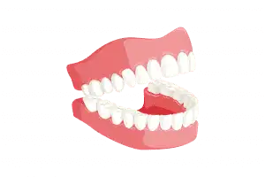 Discover 8 Significant Long Term Effects Of Bulimia 2 teeth 3414722 1920