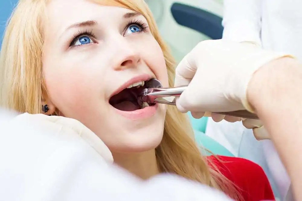 Everything You Need To Know About Wisdom Teeth Infection After Removal 2 shutterstock 226195237
