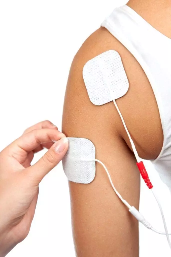 3116785 electrodes of tens device on shoulder tens therapy nerve stimu