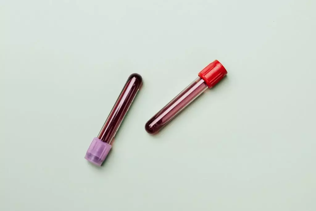 Two vials of blood sample