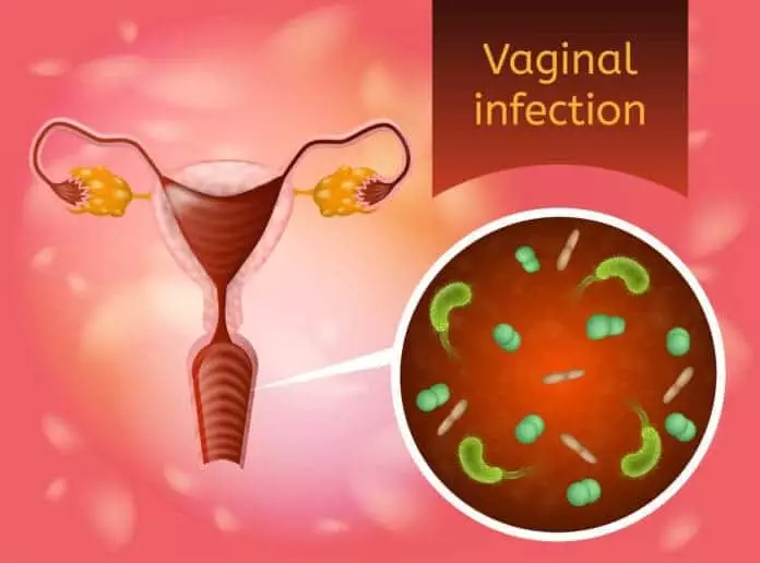 how to prevent yeast infection while taking antibiotics