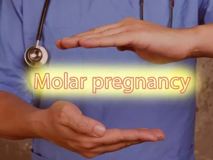 what is molar pregnancy