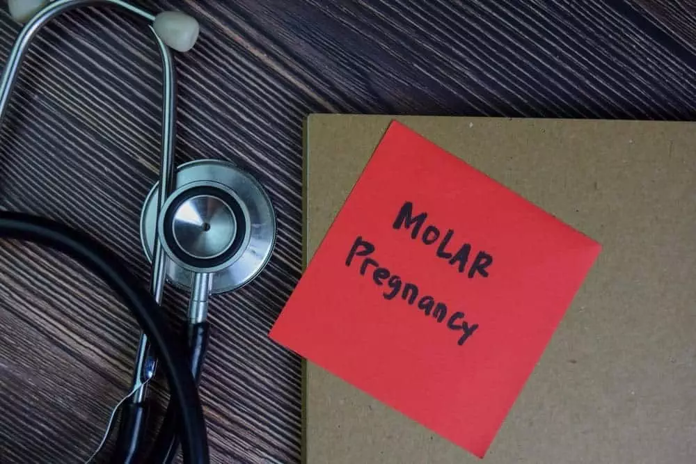 what is a molar pregnancy